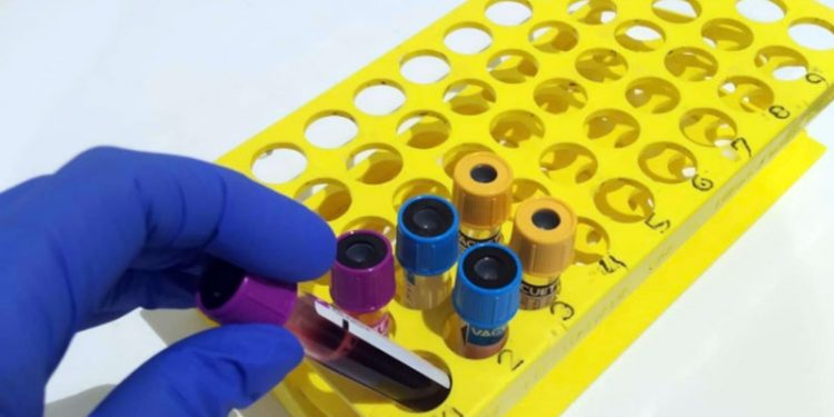 Situación insostenible en los laboratorios clínicos de los centros sanitarios de Andalucía por la aparición de ómicron