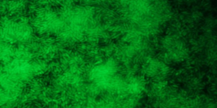 Biofilm Bacterias Microcospio