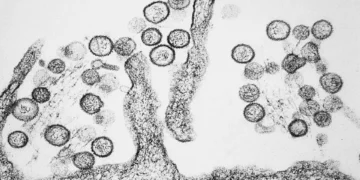 Brote de hantavirus en un crucero desata una crisis sanitaria internacional tras tres muertes en el Atlántico